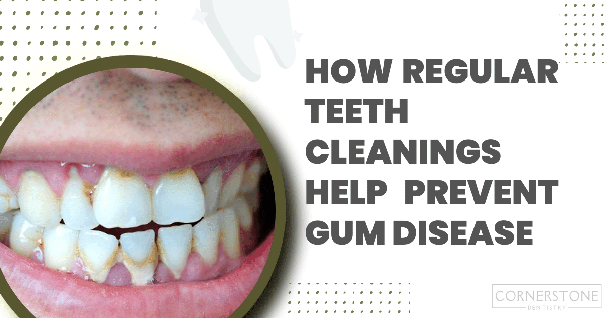 How Regular Teeth Cleanings Help Prevent Gum Disease