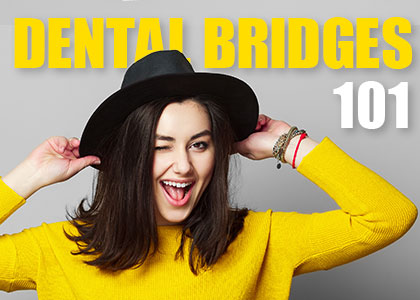 Dental Bridges 101