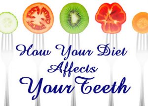 How you diet affects your teeth.