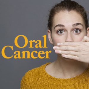 Anderson dentists, Dr. Hardy & Dr. Wilson at Cornerstone Dentistry tell patients about oral cancer – signs and symptoms, risk factors, and the importance of getting screened.