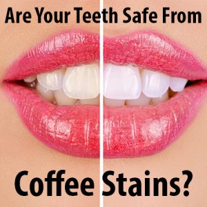 You don’t have to put up with discoloration and coffee stained teeth. Dr. Hardy & Dr. Wilson at Cornerstone Dentistry, tell you about teeth whitening in Anderson.