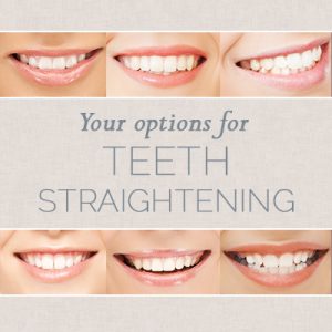 Anderson dentists, Dr. Hardy & Dr. Wilson at Cornerstone Dentistry share all you need to know about choosing the right teeth straightening option for you.
