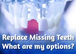 Anderson dentists, Dr. Hardy & Dr. Wilson of Cornerstone Dentistry discuss the tooth replacement options available to replace missing teeth and restore your smile.