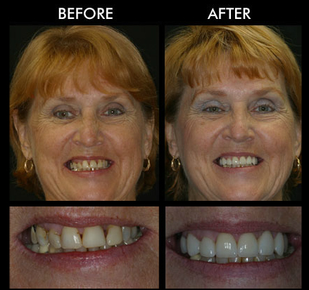 Cosmetic Dentist in Anderson SC Cosmetic Dentist in Anderson SC