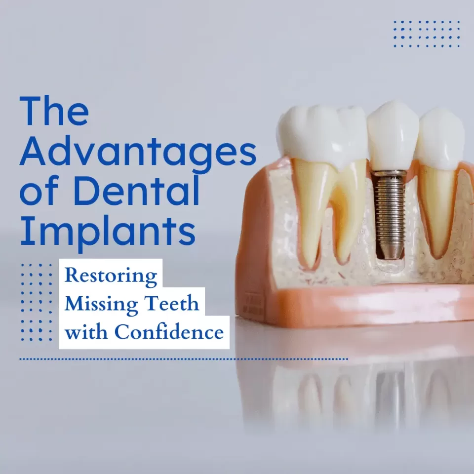 The Advantages of Dental Implants: Restoring Missing Teeth with Confidence