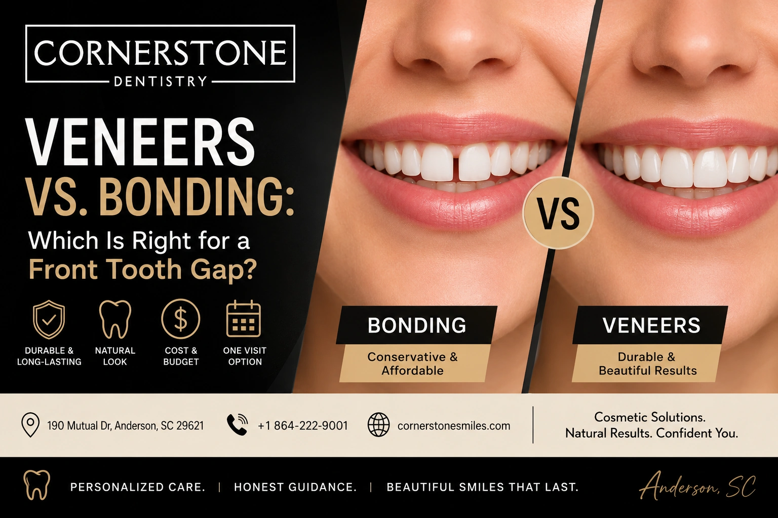 Cornerstone Dentistry Veneers vs Bonding Banner 1 Veneers Vs. Bonding