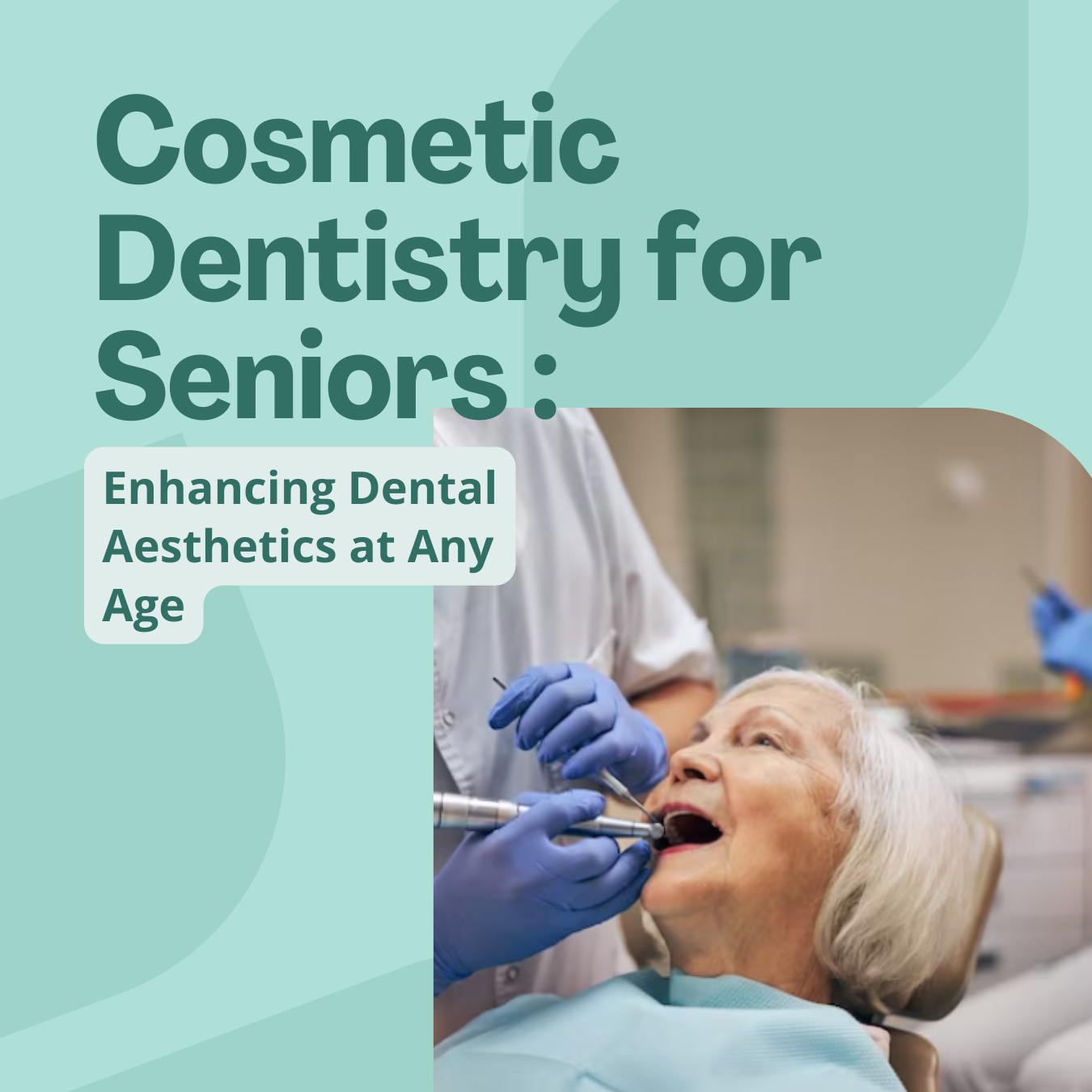 Cosmetic Dentistry for Seniors-Elders