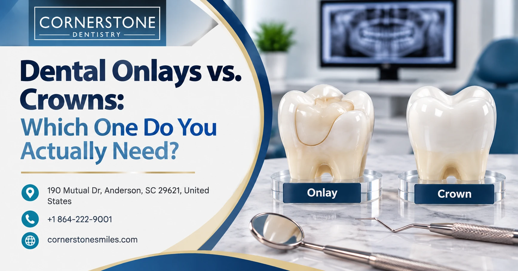 Dental Onlays featured Dental Onlays vs. Crowns: Which One Do You Actually Need?