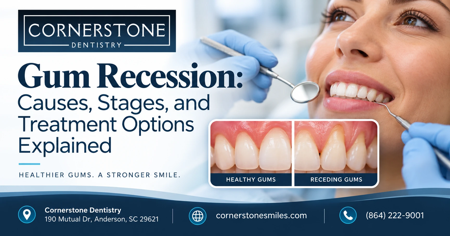 Gum Recession featured Gum Recession: Causes, Stages, and Treatment Options Explained