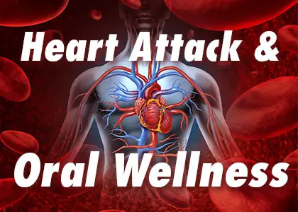 Oral Wellness and Heart Attack