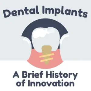 Anderson dentists, Dr. Hardy & Dr. Wilson of Cornerstone Dentistry discuss dental implants and shares some information about their history.