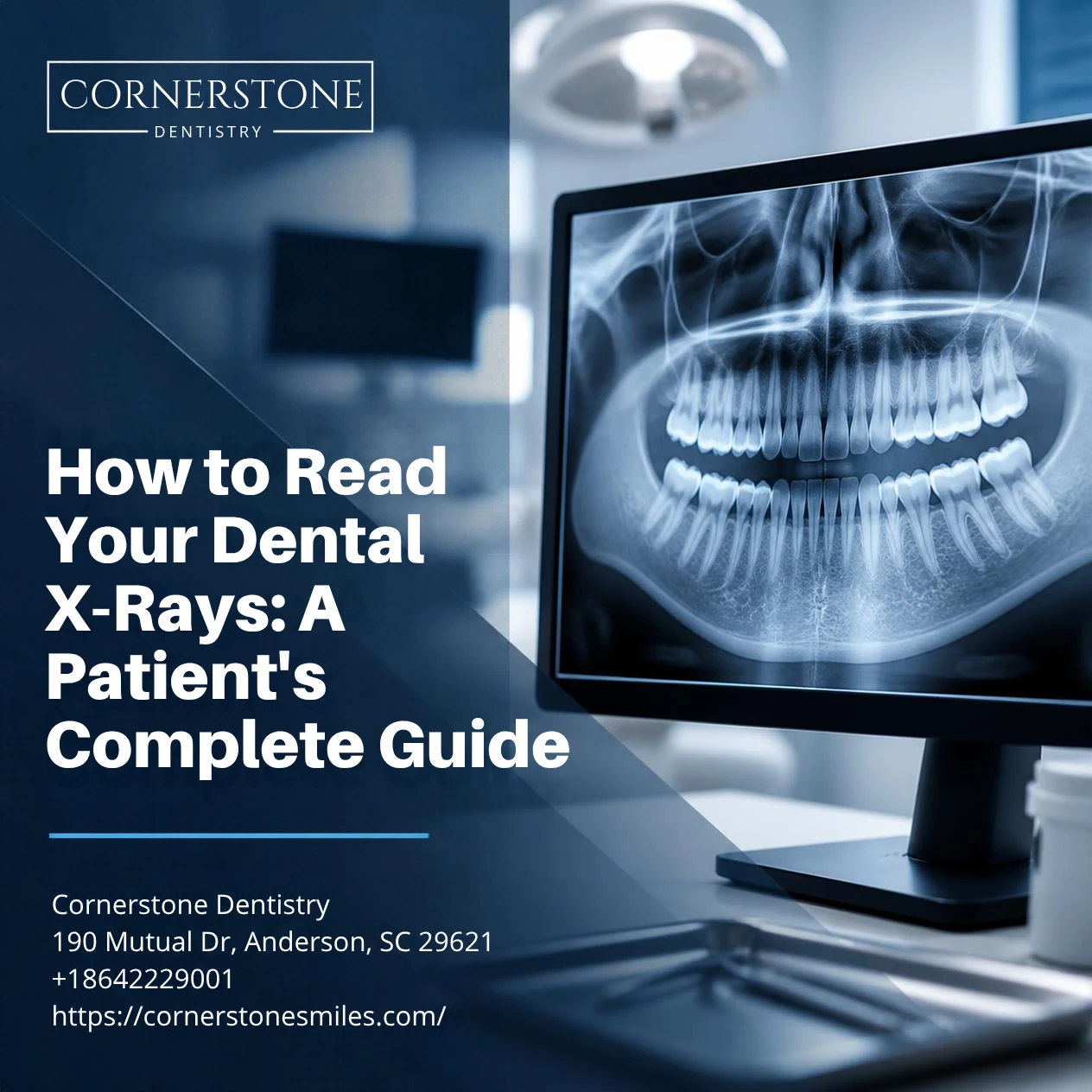 How to Read Your Dental X Rays feat How to Read Your Dental X-Rays: A Patient's Complete Guide