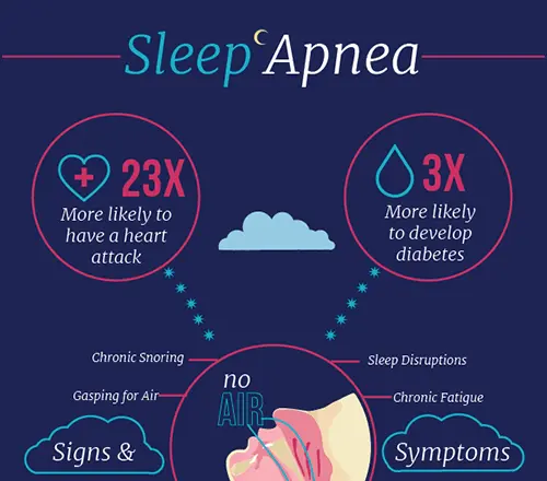 Sleep Apnea Infographic