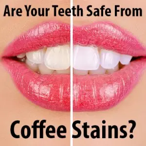 You don’t have to put up with discoloration and coffee stained teeth. Dr. Hardy & Dr. Wilson at Cornerstone Dentistry, tell you about teeth whitening in Anderson.