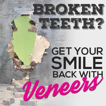 Broken Teeth - Get Smile Back With Veneers