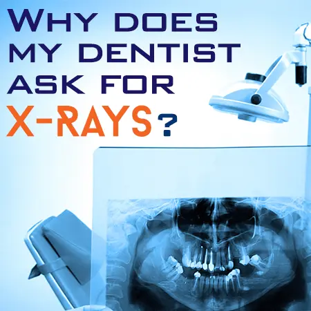 X-Ray Dental Exams