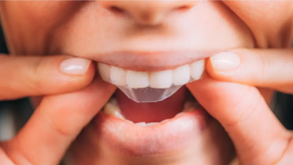 assessing the effectiveness of whitening strips in cosmetic dentistry