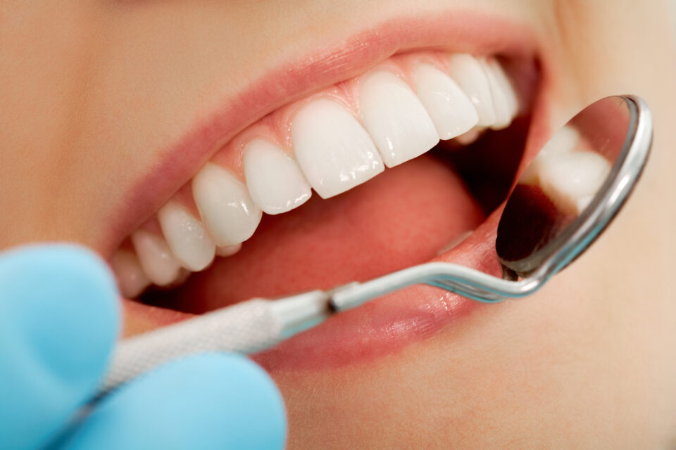 Professional Teeth Cleaning and Whole-Body Health