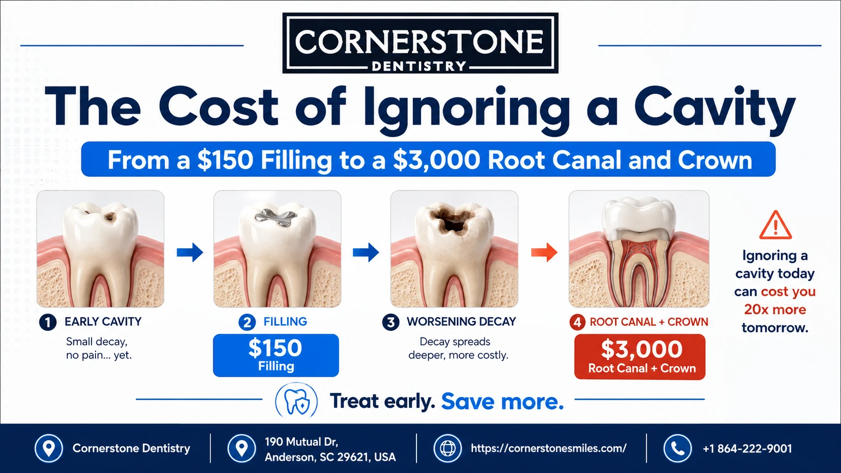 cost of ignoring a cavity featured 1 Cost of Ignoring a Cavity: Filling vs Root Canal
