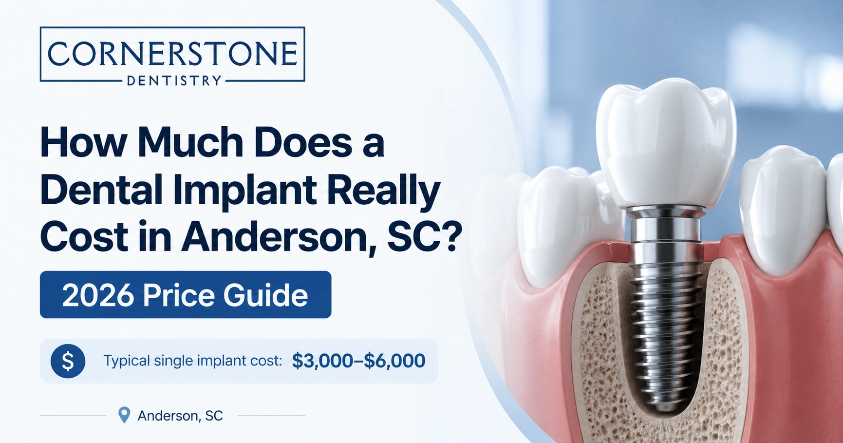 dental implant cost in anderson sc