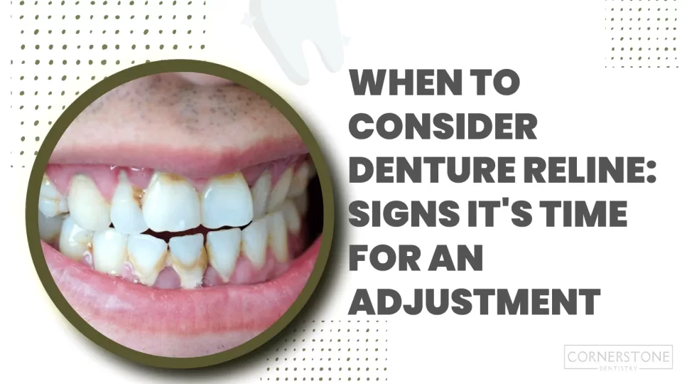 when to consider denture reline signs it's time for an adjustment